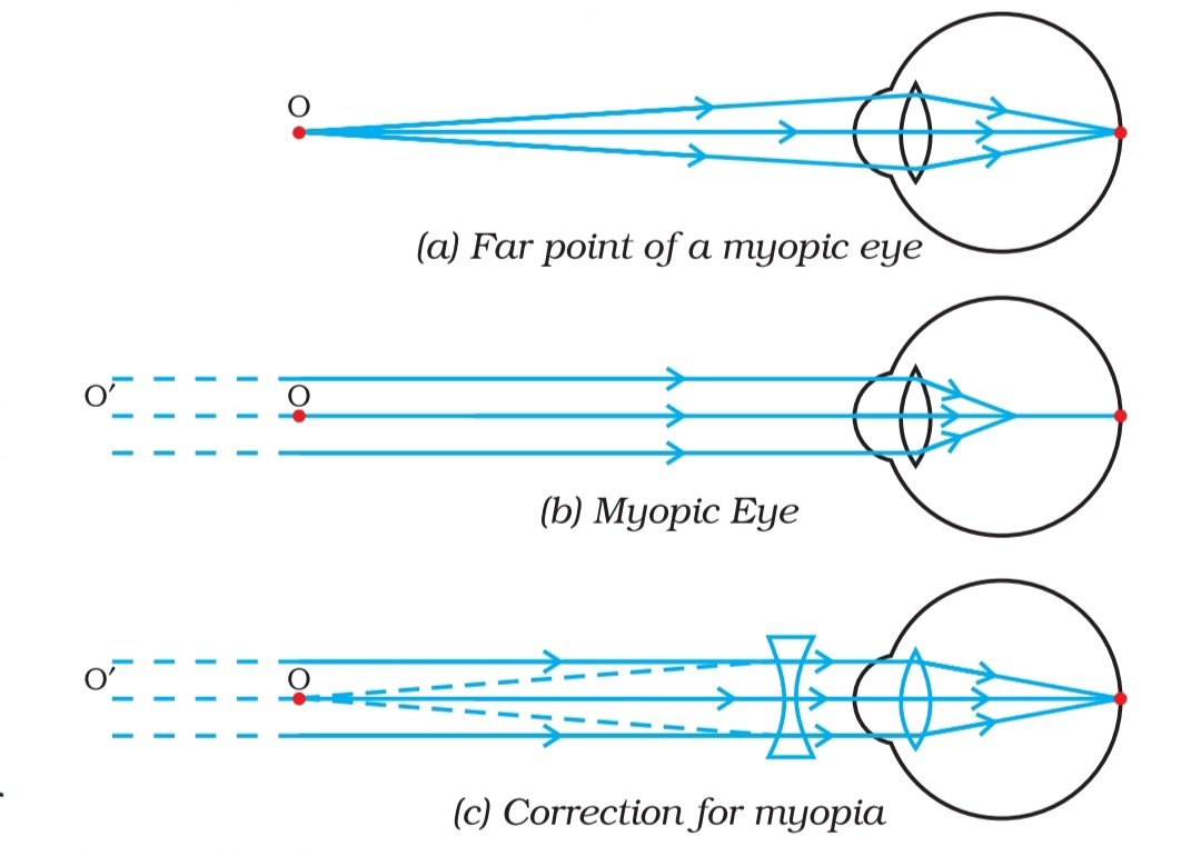 far point of eye